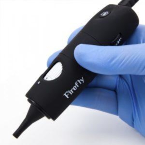 Firefly USB Otoscope